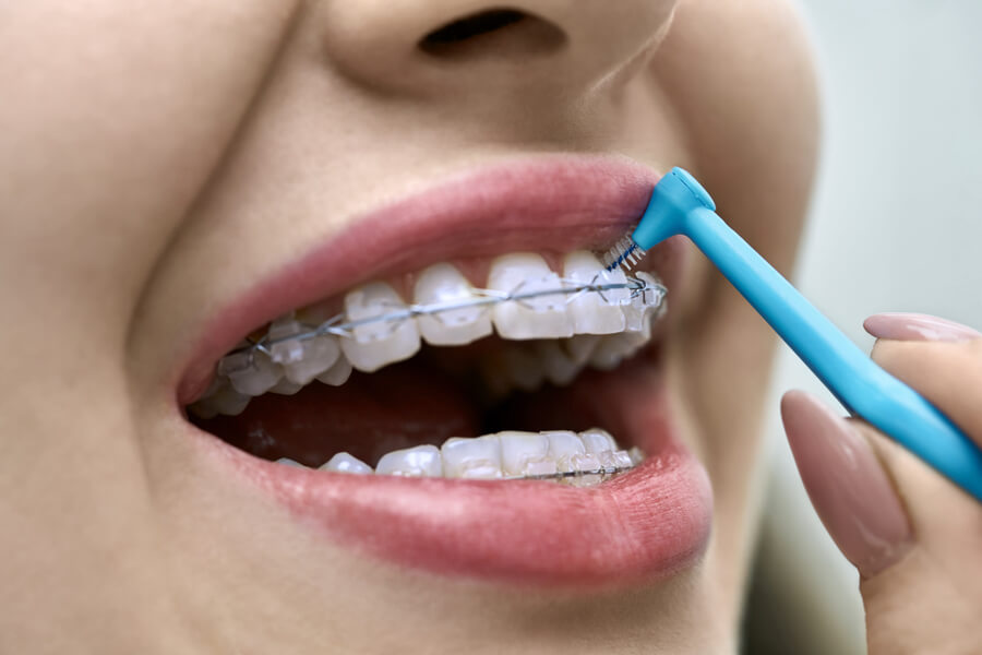 Come usare lo scovolino per denti