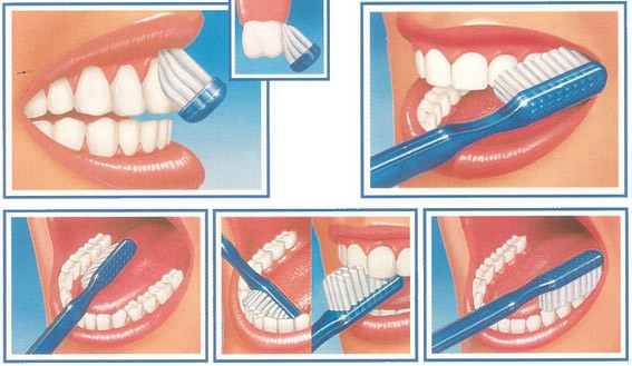 tecnica spazzolamento denti