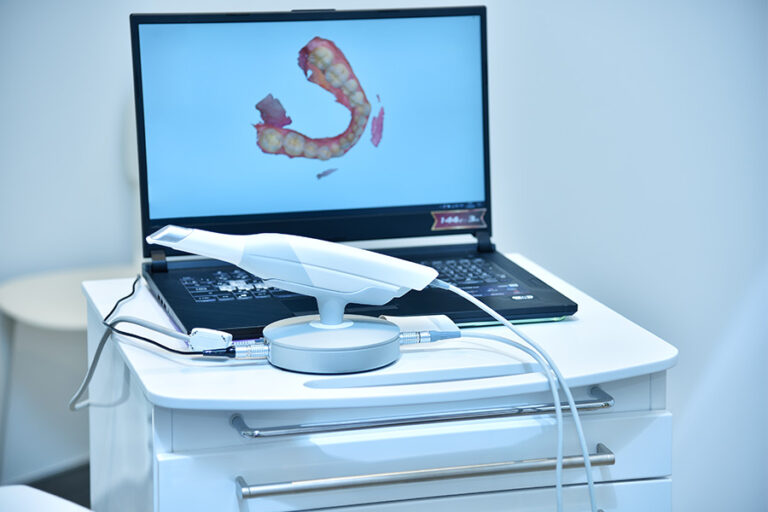 Tutto ciò che c'è da sapere sull'impronta dentale digitale Wedental Care