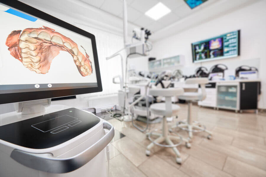 Impronta dentale digitale